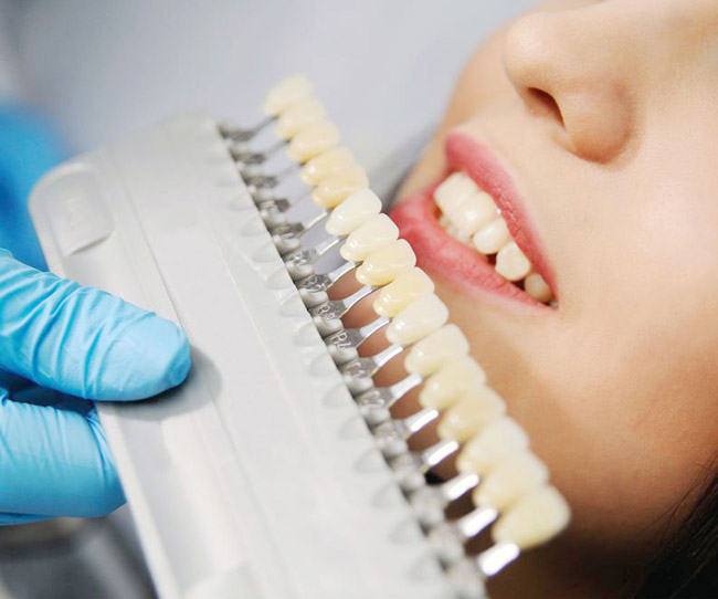https://vancouverharbourdental.incloud365.ca/wp-content/uploads/2023/07/vancouverharbourdental_services_cosmeticl_dentistry_1.jpg